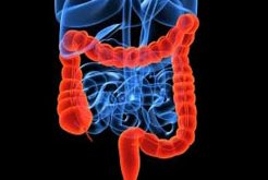 Colorretal OK NET OK ASCO 2016