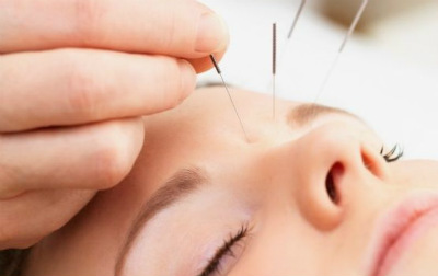 Acupuntura NET OK