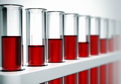 Biopsia Liquida NET OK