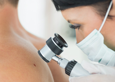 Melanoma ESMO NET OK