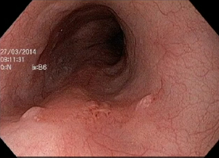 ONIDX GSTI 001 Figura1