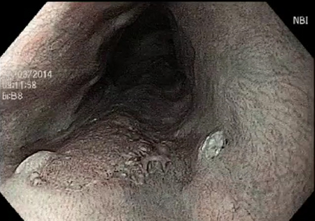 ONIDX GSTI 001 Figura2