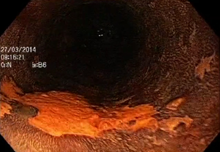 ONIDX GSTI 001 Figura3