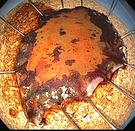 ONIDX GSTI 001 Figura4