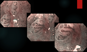 ONIDX GSTI 001 Figura7