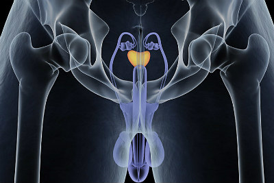 Prostata 2018 2 NET OK