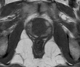 Figura 2 drielle text05