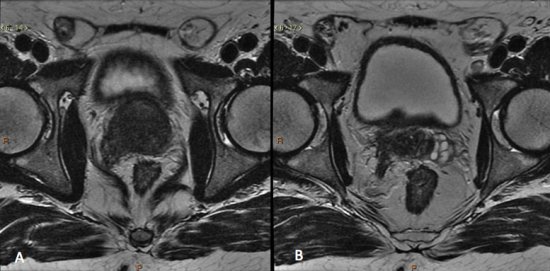 Figura 6 drielle text05