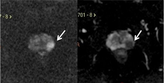 Figura 7 drielle text05