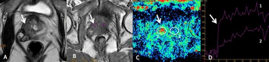 Figura 8 drielle text05