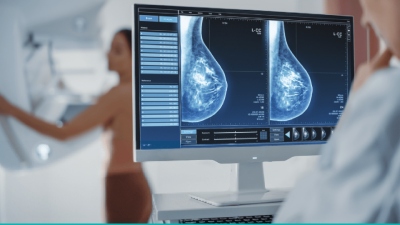 radio mamaria haoc bx