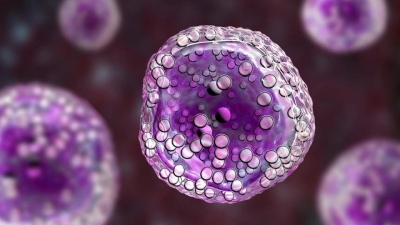 waldenstrom macroglobulinemia bx