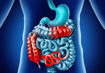 obstrucao intestinal