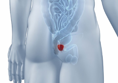 prostata 23