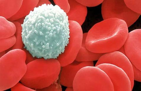 leucemia1.jpg