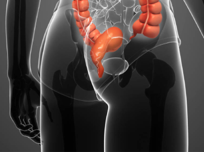 Diretrizes para o rastreamento do câncer anal em grupos de alto risco